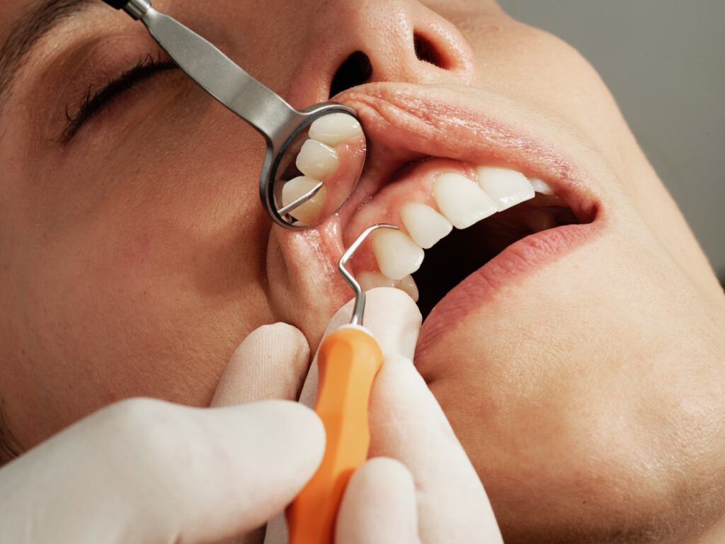Dental Implant Procedure