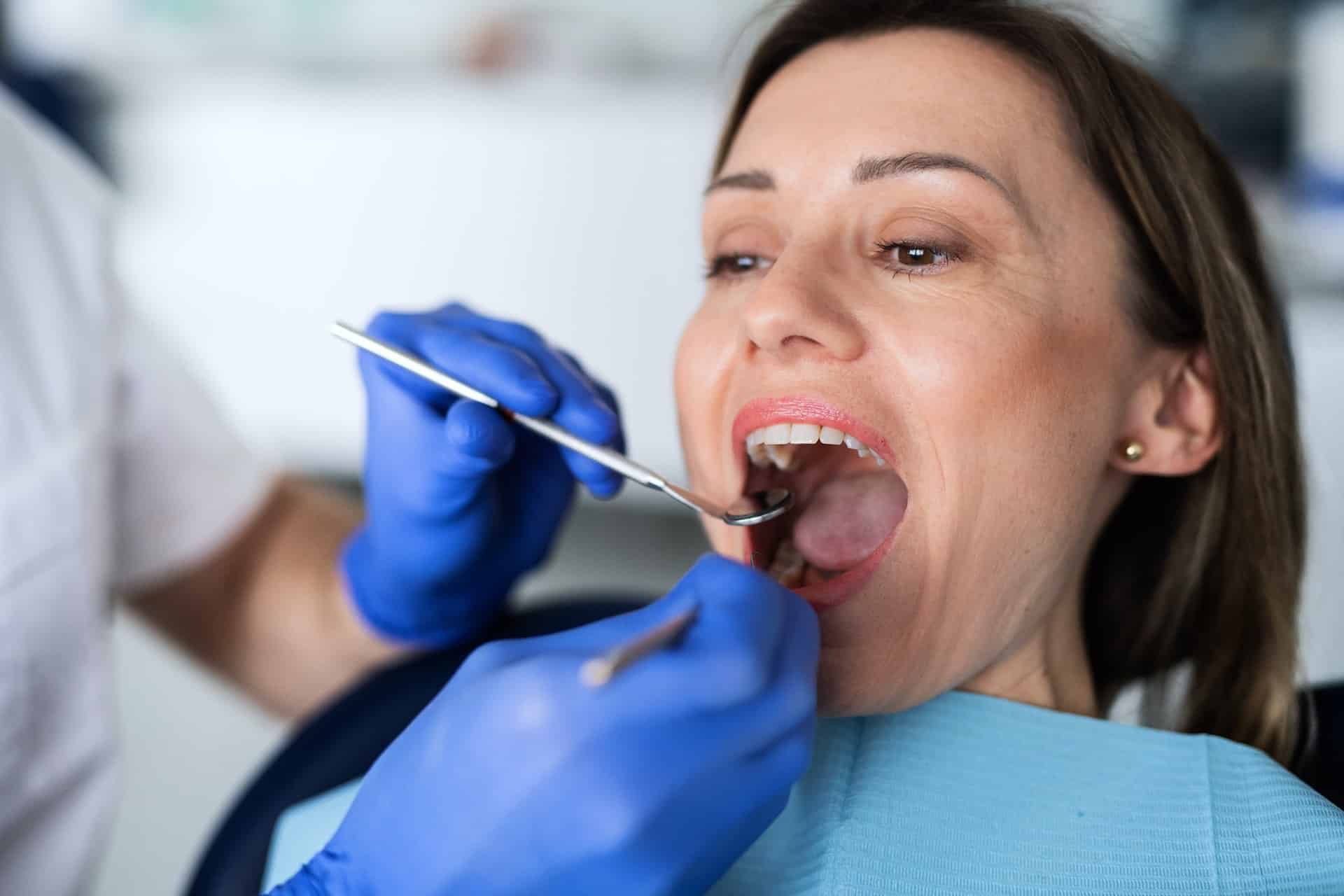 Teeth Bonding