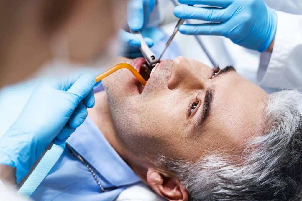 dental implants