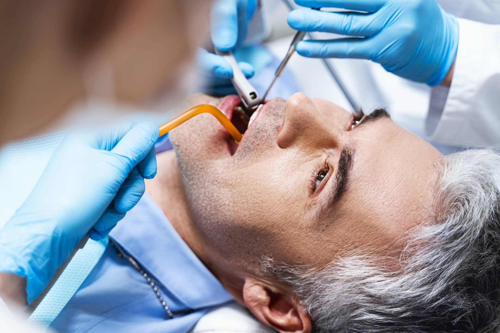 dental implants