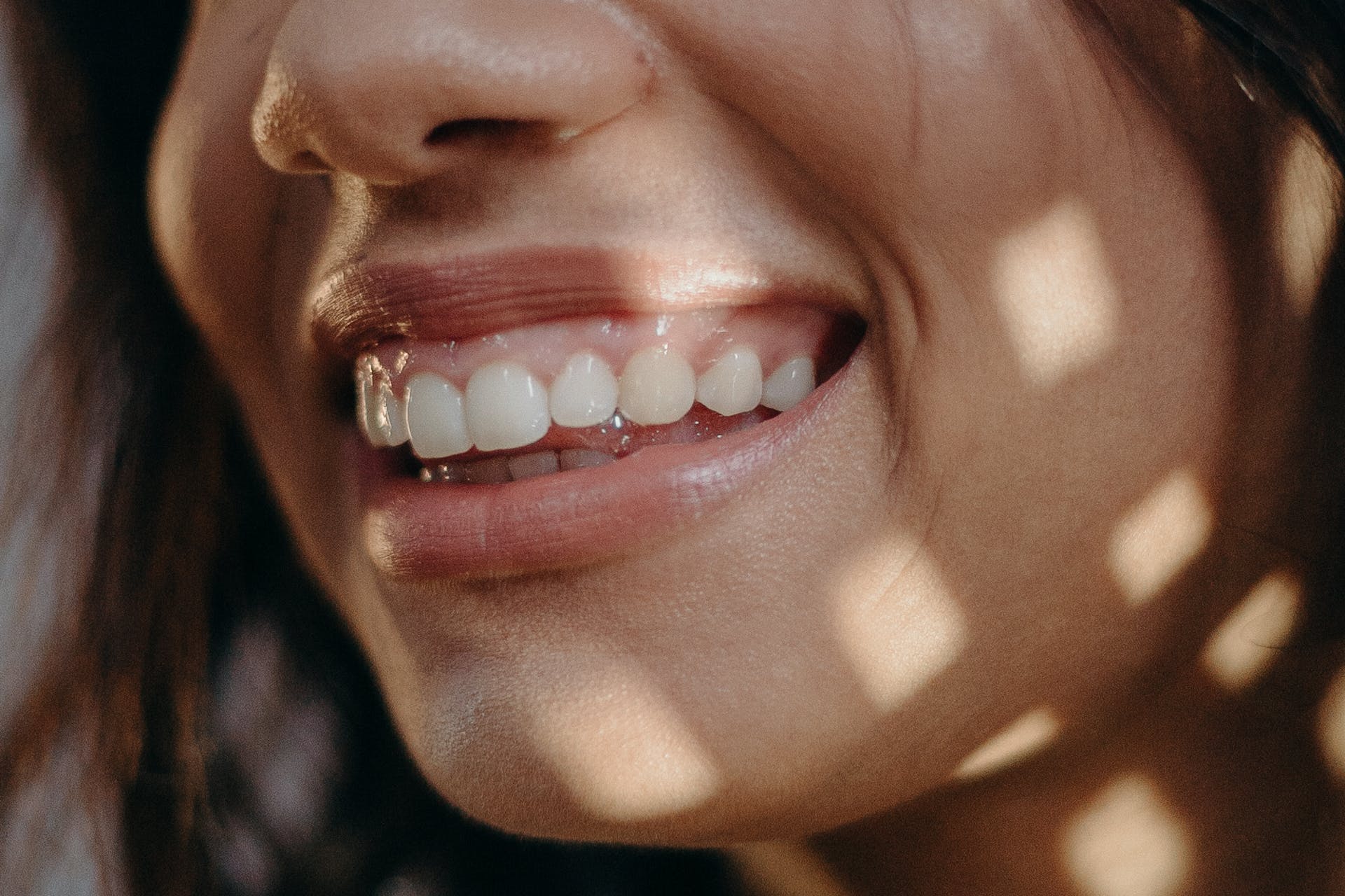 woman's teeth