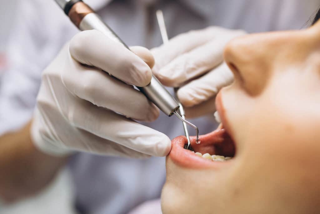 dental implant