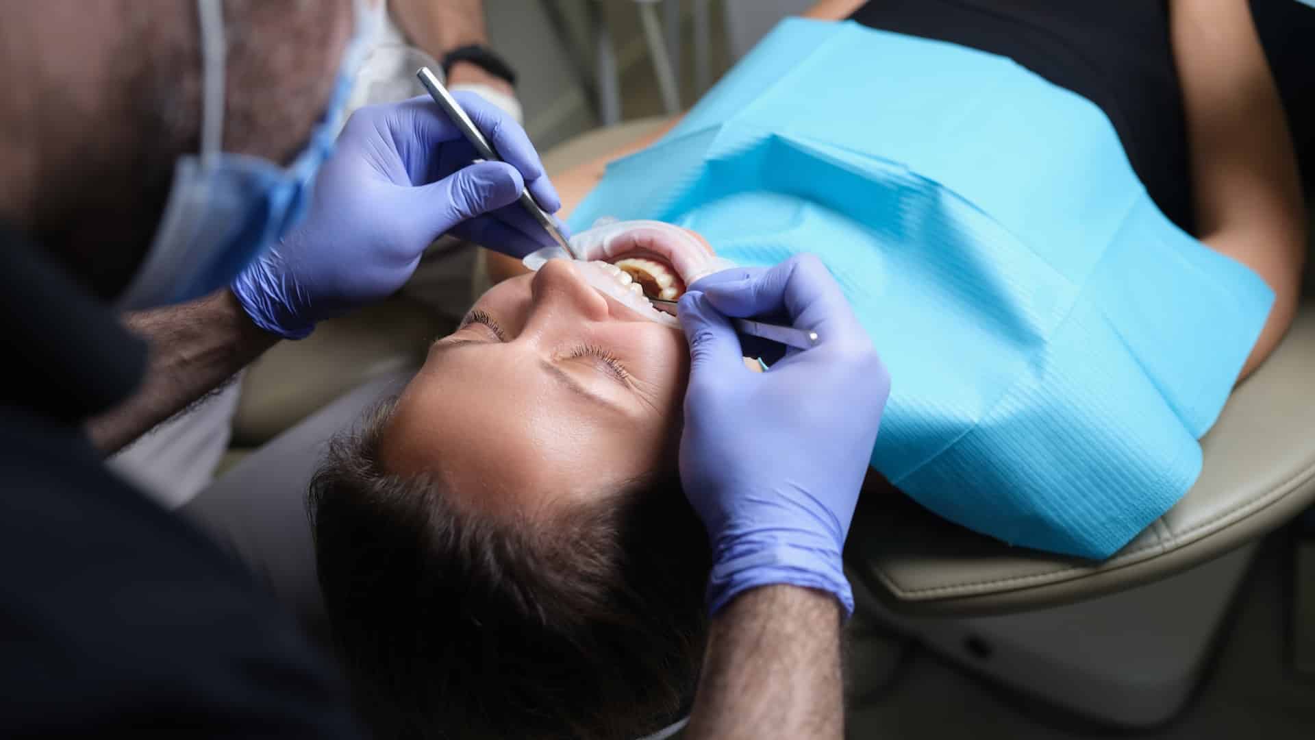 dental crowns