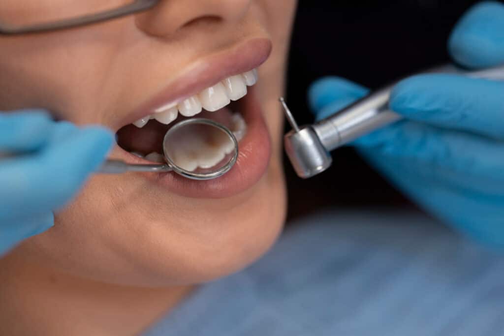 dental treatment