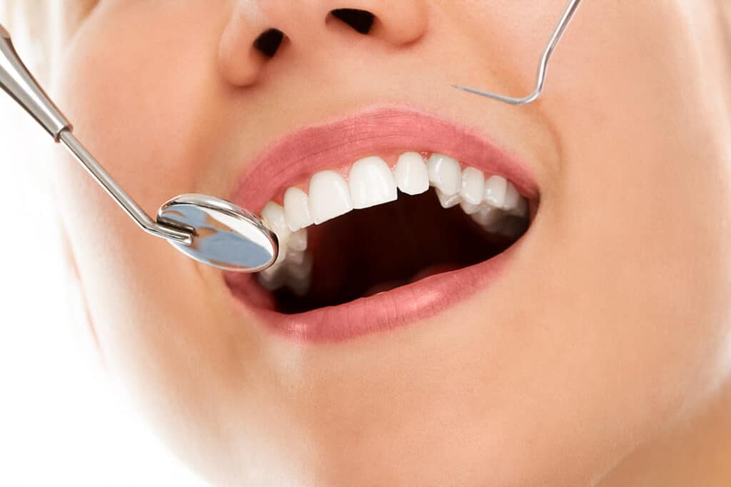 Dental Crown