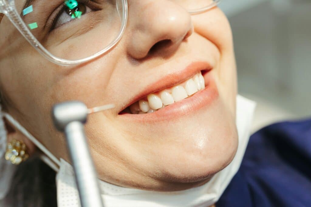 Tooth Coloured Fillings