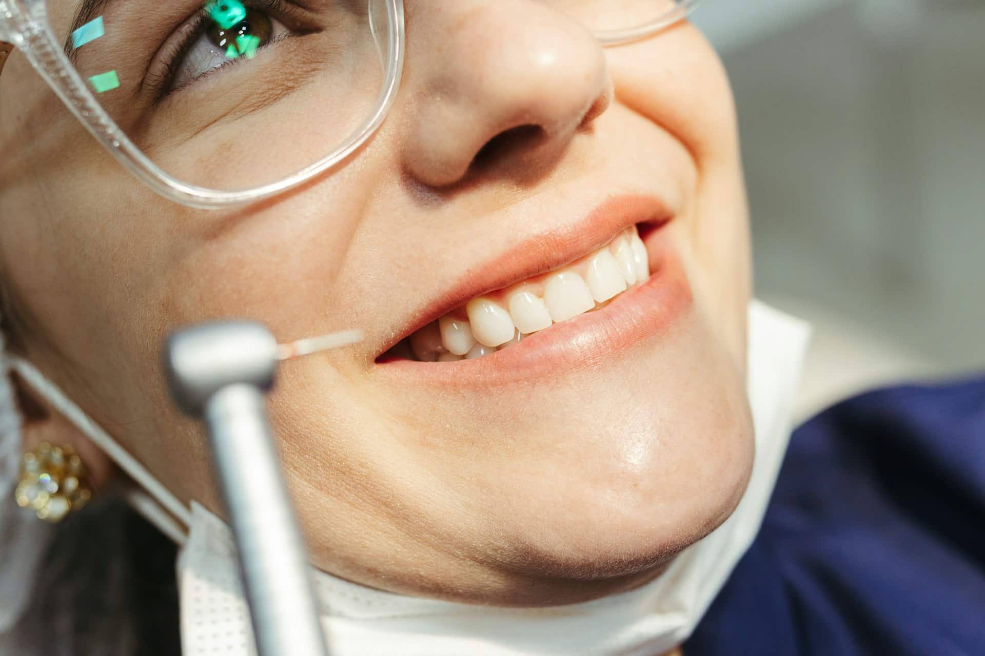 Tooth Coloured Fillings