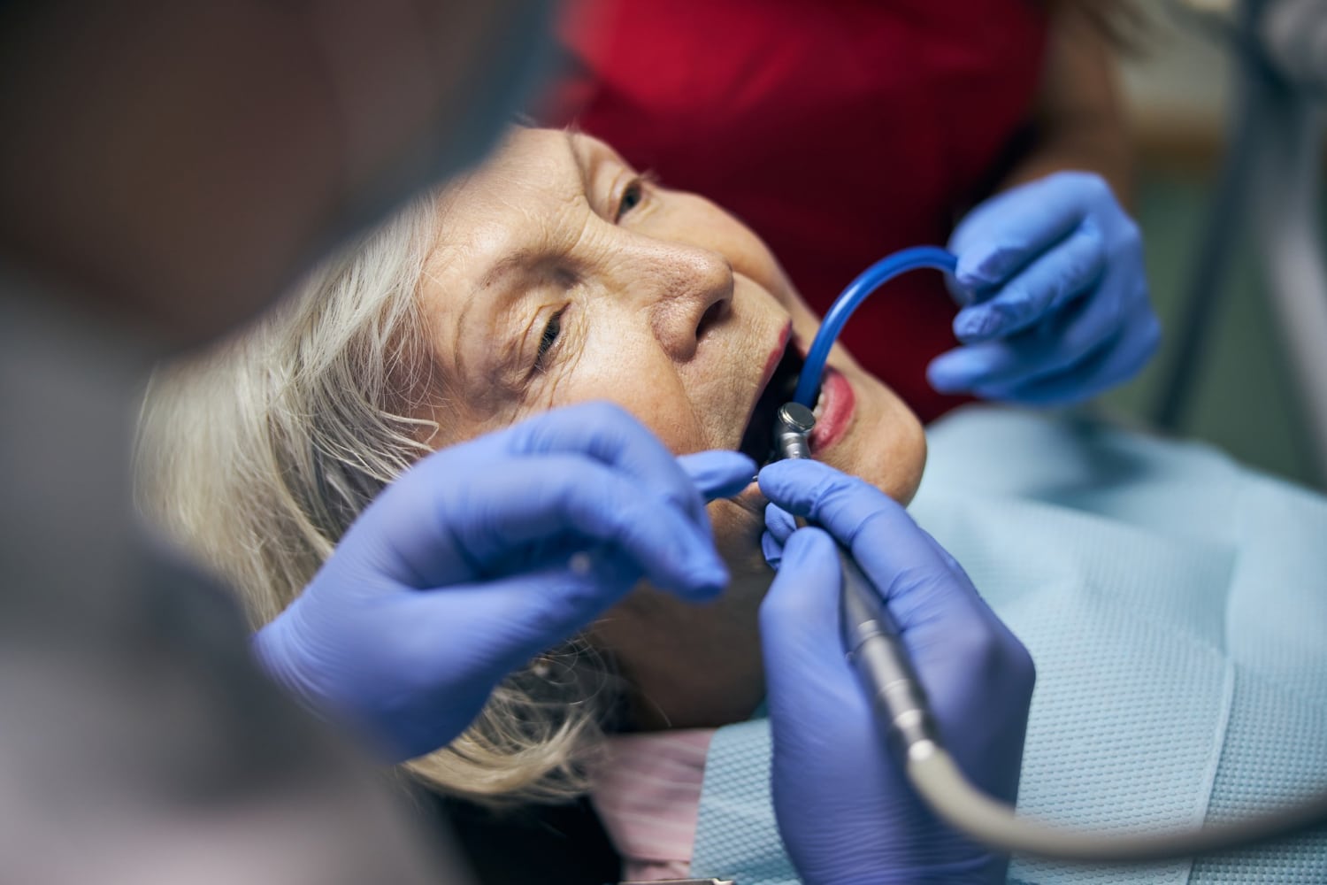 dental bridges