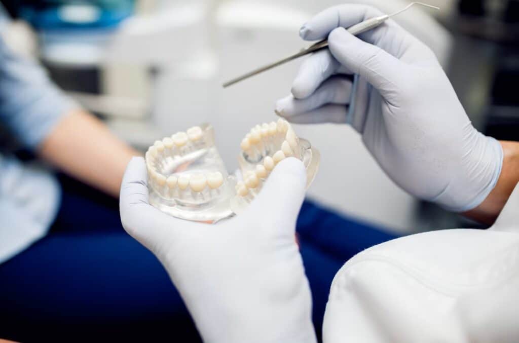 Dental Bridges