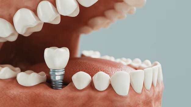 Dental Implants