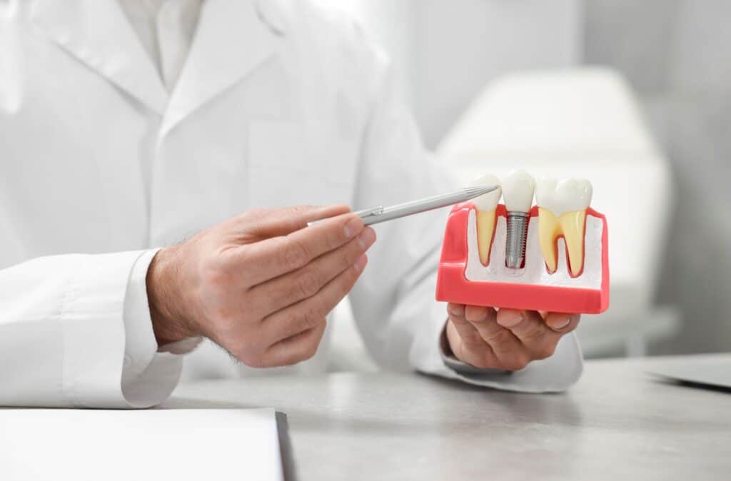 dental implant