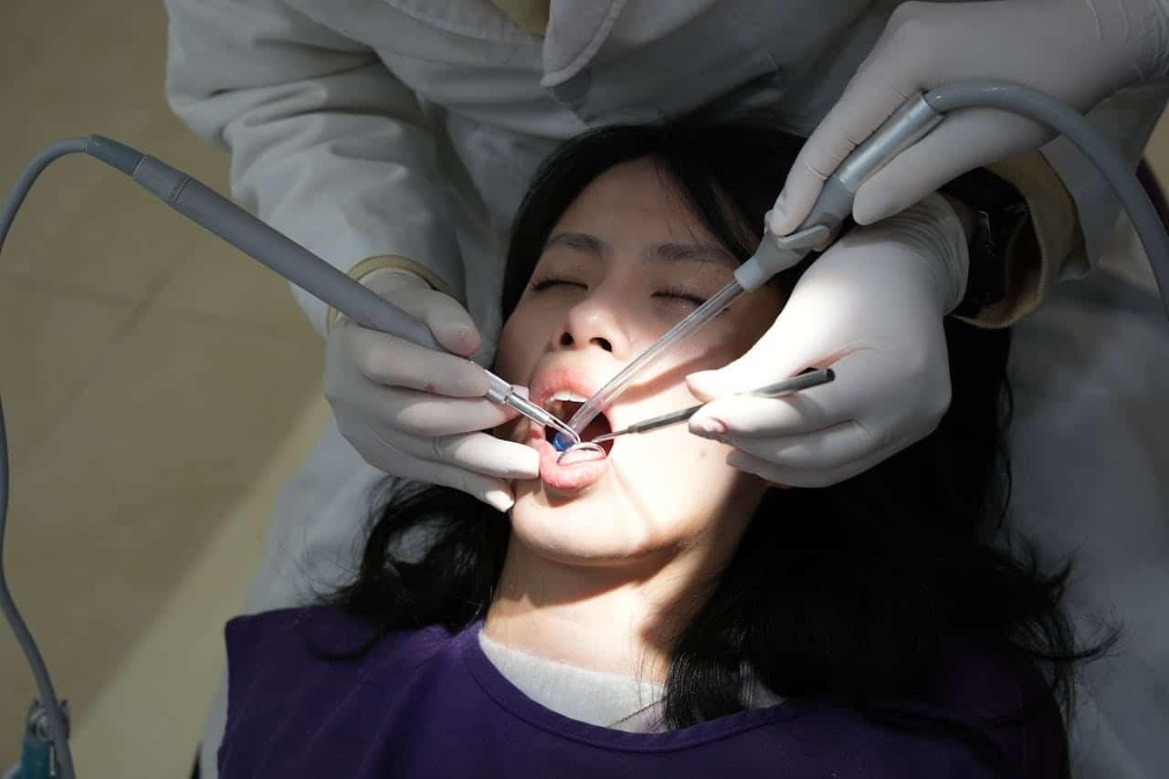 Dental Bridges