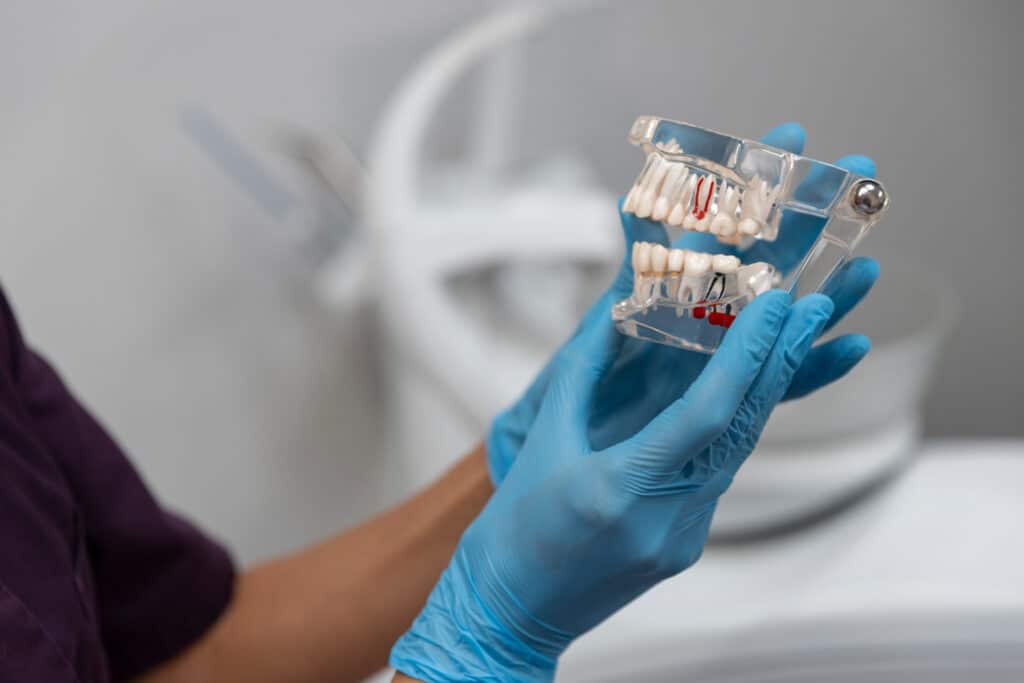 Dental Implants