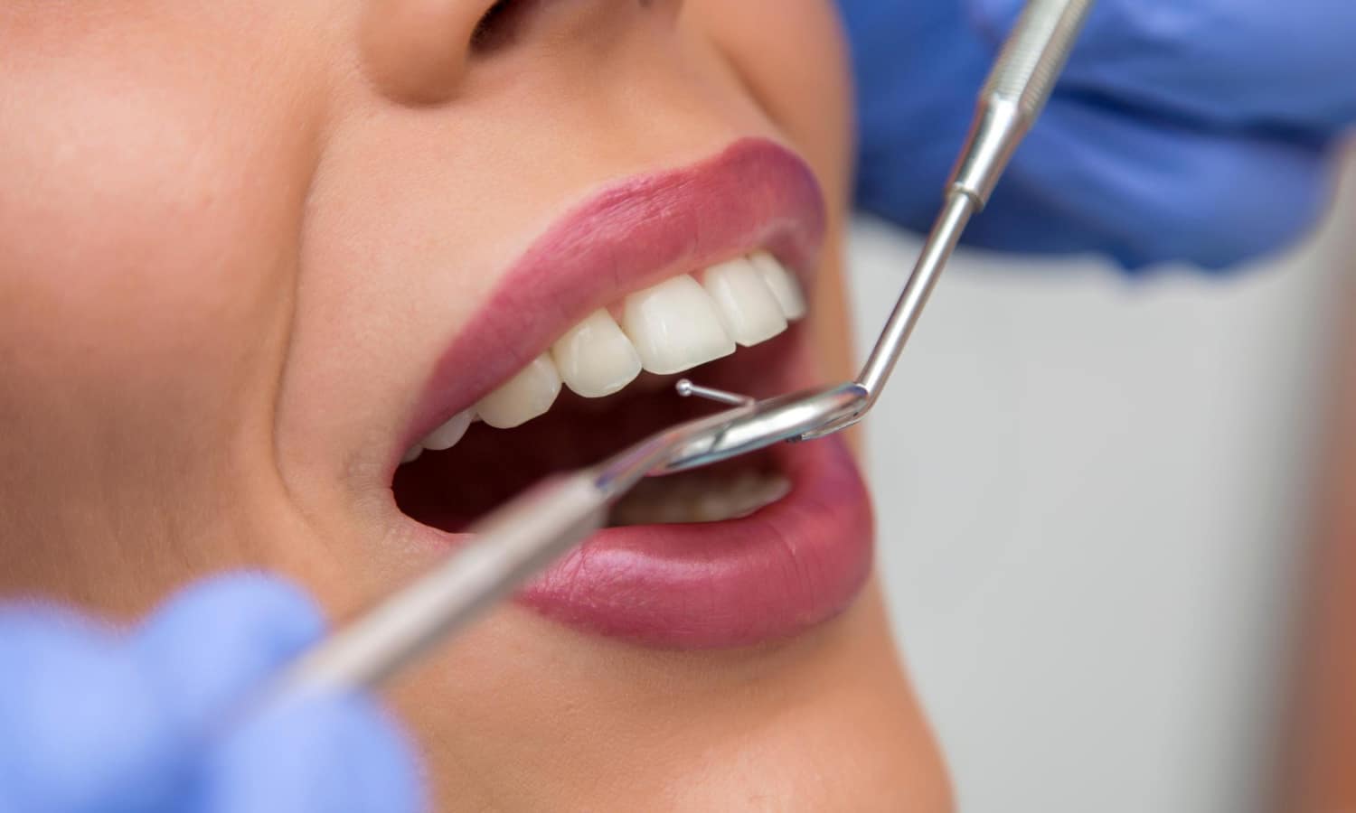 implant dentistry