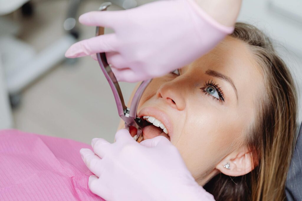 Dental Extraction
