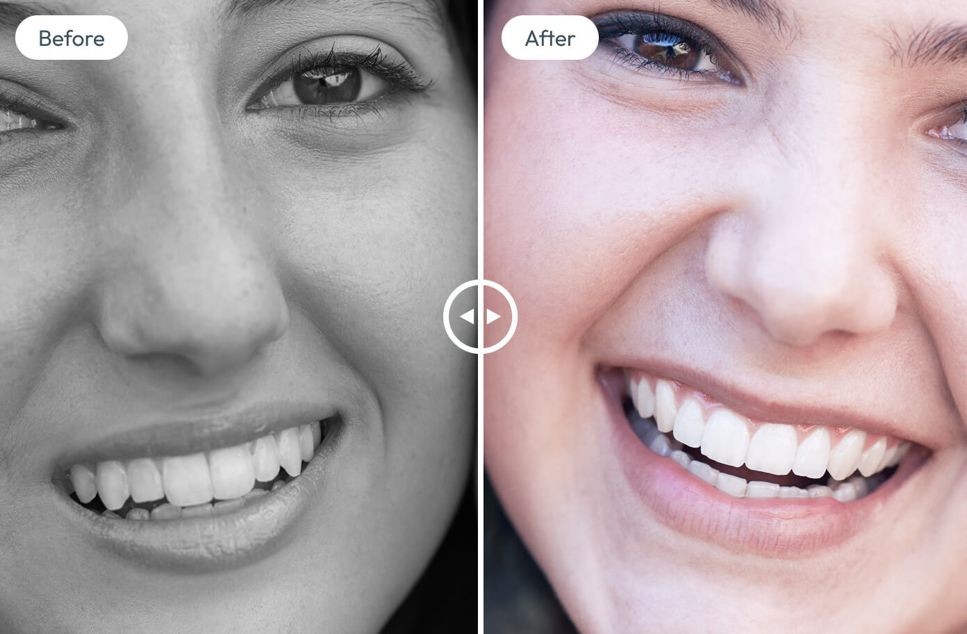 Whitening for Life dental care photograph